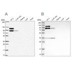 Western blot analysis using Anti-LIMA1 antibody HPA052645 (A) shows similar pattern to independent antibody HPA023871 (B).