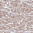 Anti-JPH2 Antibody
