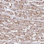 Anti-JPH2 Antibody
