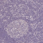 Immunohistochemical staining of human lymph node shows no cytoplasmic positivity in germinal center cells as expected.