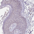 Immunohistochemical staining of human skin shows no positivity in squamous epithelial cells as expected.