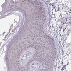 Immunohistochemical staining of human skin shows no positivity in squamous epithelial cells as expected.