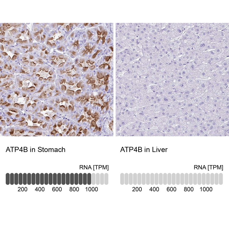 Anti-ATP4B Antibody
