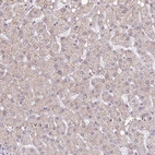 Immunohistochemical staining of human liver shows no positivity in hepatocytes as expected.