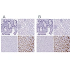 Immunohistochemical staining of human gastrointestinal, kidney, liver and stomach using Anti-ATP4B antibody HPA052649 (A) shows similar protein distribution across tissues to independent antibody HPA045400 (B).