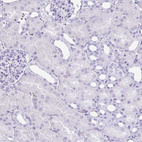 Immunohistochemical staining of human kidney shows no positivity in cells in tubules as expected.