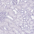 Immunohistochemical staining of human kidney shows no positivity in cells in tubules as expected.