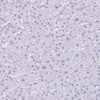Immunohistochemical staining of human liver shows no positivity in hepatocytes as expected.