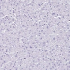 Immunohistochemical staining of human liver shows no positivity in hepatocytes as expected.