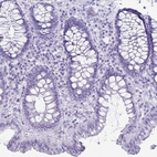 Immunohistochemical staining of human colon shows no positivity in glandular cells as expected.