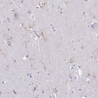 Anti-TMEM119 Antibody