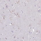 Immunohistochemical staining of human cerebral cortex shows moderate membranous positivity in microglia.