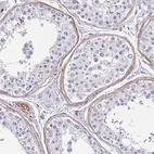 Immunohistochemical staining of human testis shows moderate cytoplasmic positivity in peritubular myoid cells.