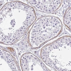 Immunohistochemical staining of human testis shows moderate cytoplasmic positivity in peritubular myoid cells.