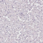 Immunohistochemical staining of human liver shows no positivity in hepatocytes as expected.