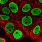 Immunofluorescent staining of human cell line MCF7 shows localization to nucleoplasm.