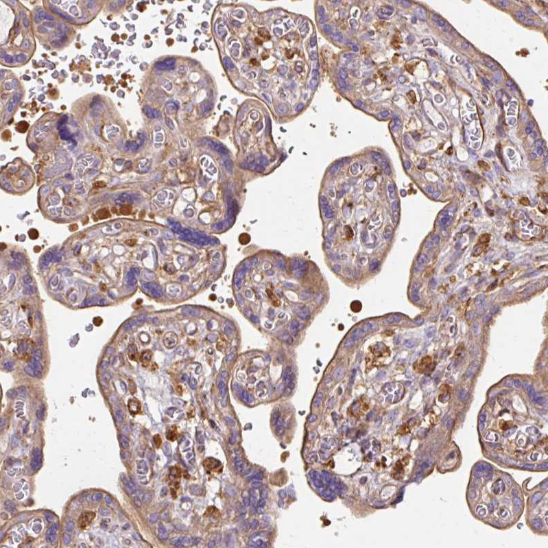 Anti-TBC1D2B Antibody