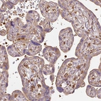 Anti-TBC1D2B Antibody