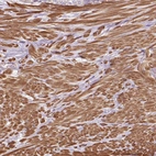 Immunohistochemical staining of human prostate shows strong cytoplasmic positivity in smooth muscle cells.