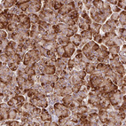 Immunohistochemical staining of human pancreas shows stron cytoplasmic positivity in exocrine glandular cells.