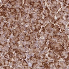 Immunohistochemical staining of human pancreas shows stron cytoplasmic positivity in exocrine glandular cells.