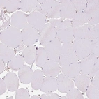 Immunohistochemical staining of human skeletal muscle shows no positivity in myocytes.