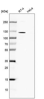 Western blot analysis in human cell line RT-4 and human cell line HeLa.
