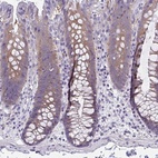 Anti-LPIN3 Antibody