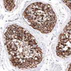 Anti-SLC7A5 Antibody
