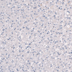 Anti-SLC7A5 Antibody