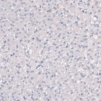 Immunohistochemical staining of human liver shows no positivity in hepatocytes as expected.
