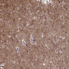 Anti-PRRT4 Antibody