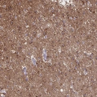 Anti-PRRT4 Antibody