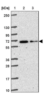 Lane 1: Marker [kDa] 250, 130, 95, 72, 55, 36, 28, 17, 10_br/_Lane 2: Human cell line RT-4_br/_Lane 3: Human cell line U-251MG sp
