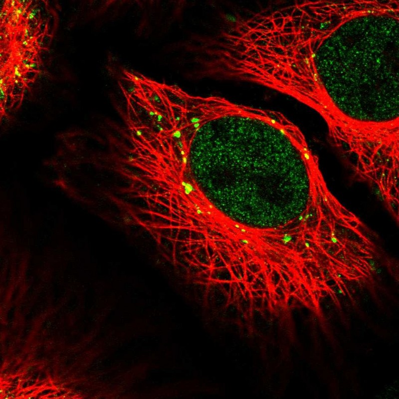 Anti-RANBP6 Antibody