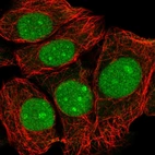 Anti-TMA16 Antibody