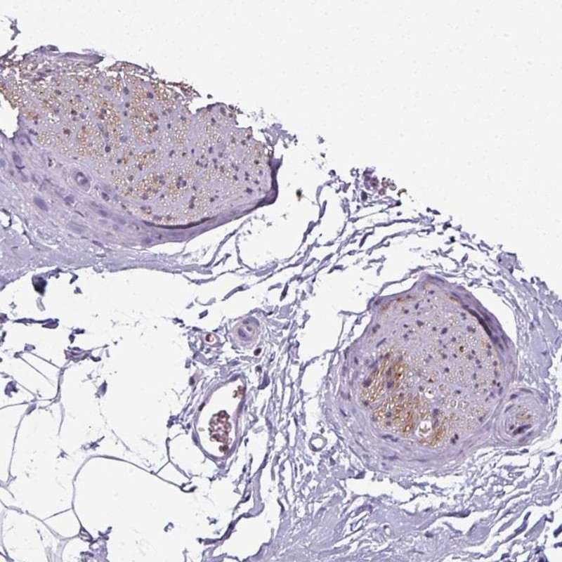 Anti-SYT8 Antibody