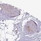 Anti-SYT8 Antibody