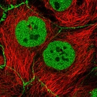 Immunofluorescent staining of human cell line CACO-2 shows localization to nucleoplasm & cell junctions.