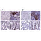 Immunohistochemical staining of human liver, lymph node, placenta and small intestine using Anti-MZB1 antibody HPA052694 (A) shows similar protein distribution across tissues to independent antibody HPA043745 (B).