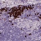 Immunohistochemical staining of human lymph node shows strong cytoplasmic positivity in a subset of lymphoid cells.