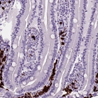 Immunohistochemical staining of human small intestine shows strong cytoplasmic positivity in lymphoid cells.