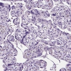 Immunohistochemical staining of human placenta shows no positivity in trophoblastic cells as expected.