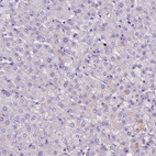 Immunohistochemical staining of human liver shows no positivity in hepatocytes as expected.