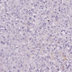 Immunohistochemical staining of human liver shows no positivity in hepatocytes as expected.