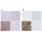 Immunohistochemical staining of human cerebral cortex, liver, pancreas and skeletal muscle using Anti-CEL antibody HPA052701 (A) shows similar protein distribution across tissues to independent antibody HPA008023 (B).