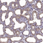 Immunohistochemical staining of human lactating breast shows moderate cytoplasmic positivity in glandular cells.