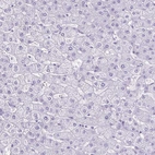 Immunohistochemical staining of human liver shows no positivity in hepatocytes as expected.