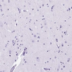 Immunohistochemical staining of human cerebral cortex shows no positivity in neurons as expected.