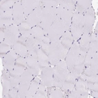 Immunohistochemical staining of human skeletal muscle shows no positivity in myocytes as expected.